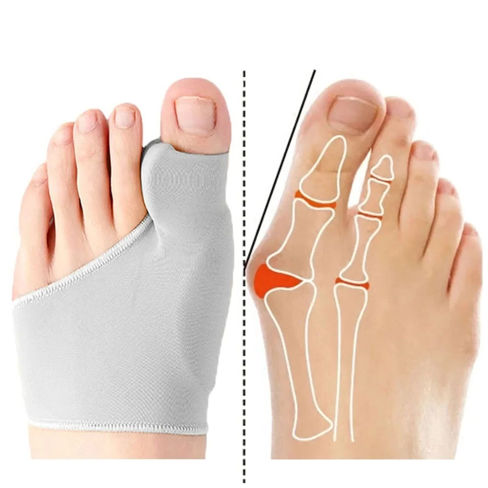 1/2Pair Toe Separator Hallux V - Ankle Brace Sock reseña y precio