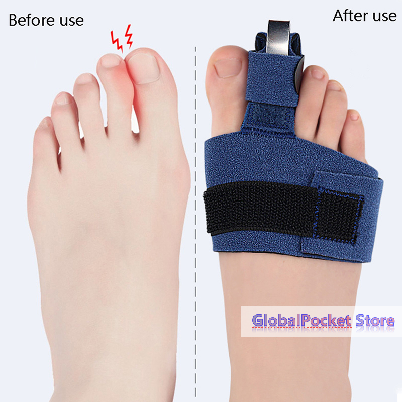 1Pcs Toe Corrector Toe Fractur - Ankle Brace Sock reseña y precio