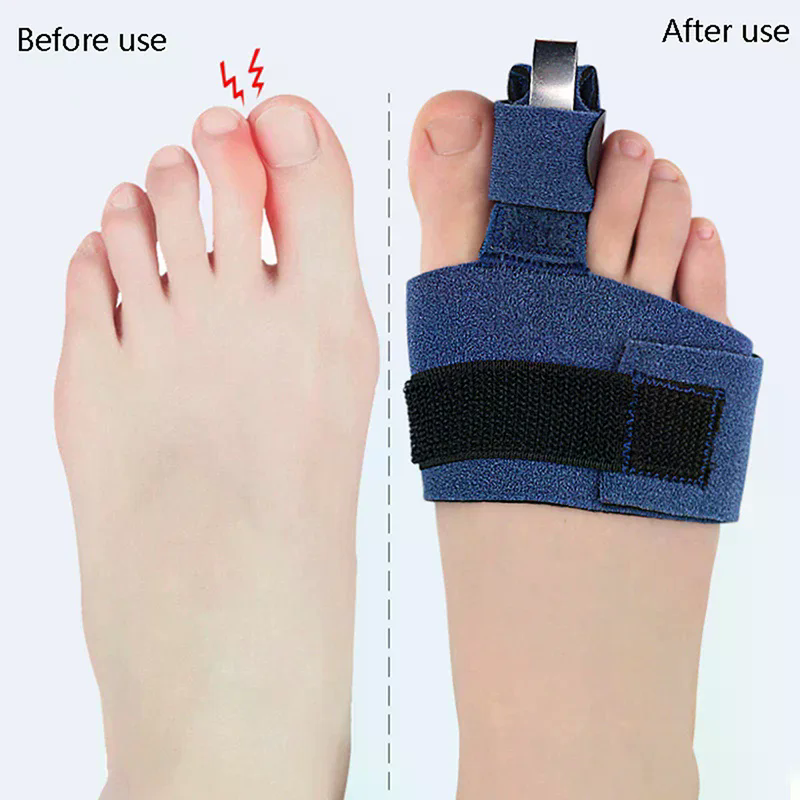 1Pcs Toe Corrector Toe Fractur - Ankle Brace Sock reseña y precio